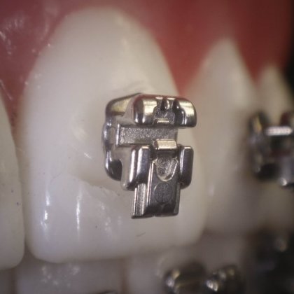 Bracket Autiligado H4