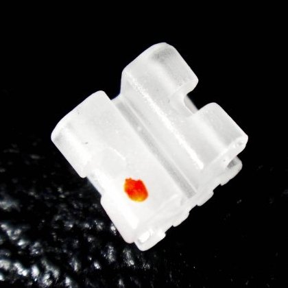 Bracket Cerámica de Alúmina